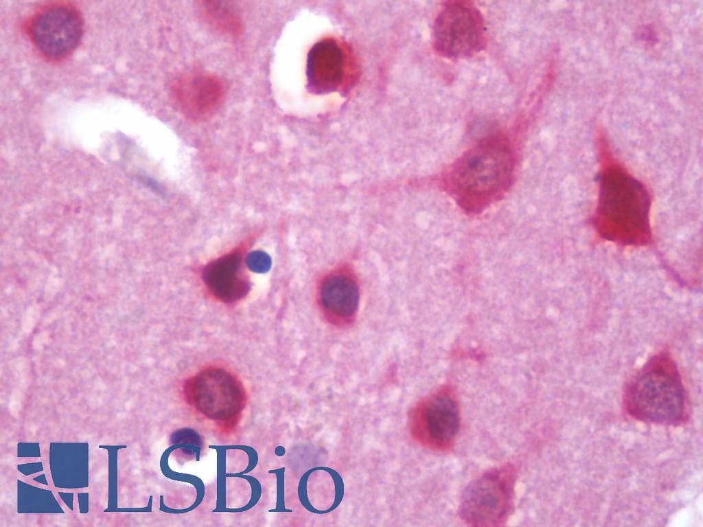 IHC-plus™ Polyclonal Rabbit anti-Human HTT / Huntingtin Antibody (C-Terminus, IHC, IF, WB)
