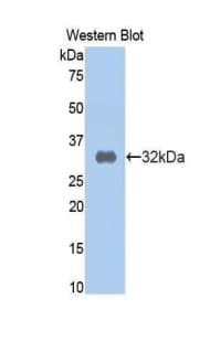 A2M / Alpha-2-Macroglobulin Antibody (aa616-856)
