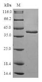 Human RGS10 Protein (Recombinant GST, N-terminus)