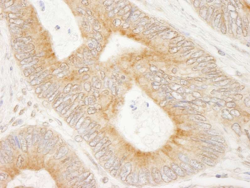 Polyclonal Rabbit anti-Human MAP7 Antibody (aa150-200, IHC)