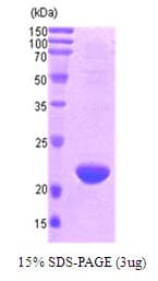 Human DIABLO / SMAC Protein (Recombinant)