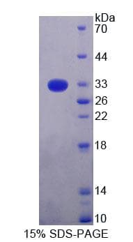 Rat TOP1MT Protein (Recombinant His-T7, N-terminus)