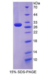 Mouse TLR2 Protein (Recombinant His-T7)