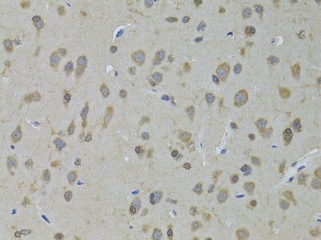 Polyclonal Rabbit anti-Human ADH5 Antibody (IHC, WB)