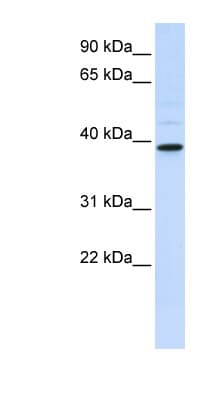 CHIA / Amcase Antibody (aa108-157)