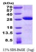 Human DNAM-1 / CD226 Protein (Recombinant His)