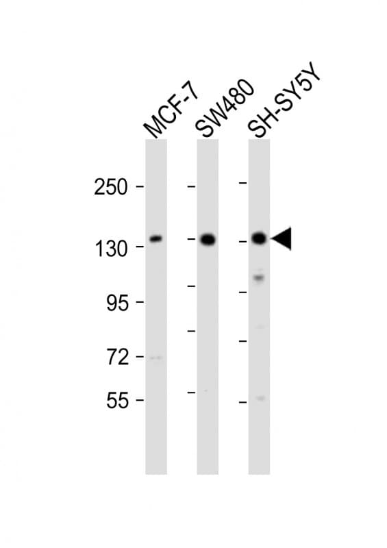 SRGAP2 Antibody (aa997-1030)