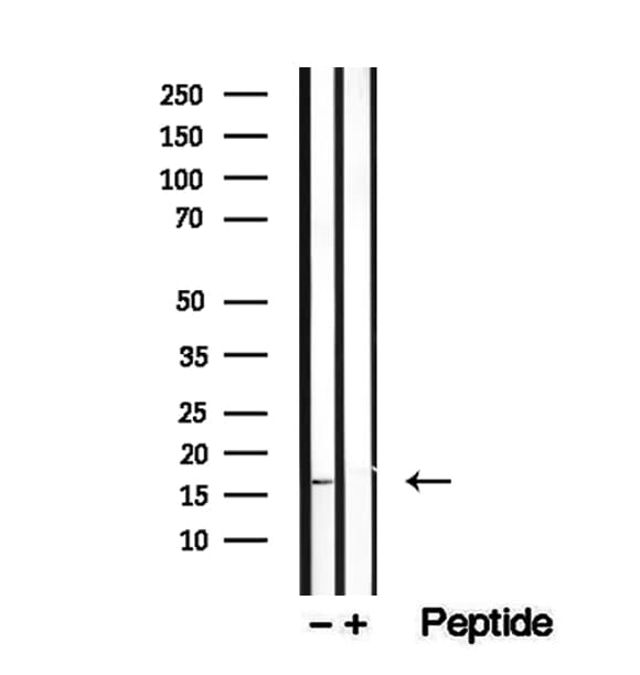 Polyclonal Rabbit anti-Human PRDX5 / Peroxiredoxin 5 Antibody (IHC, IF, WB)