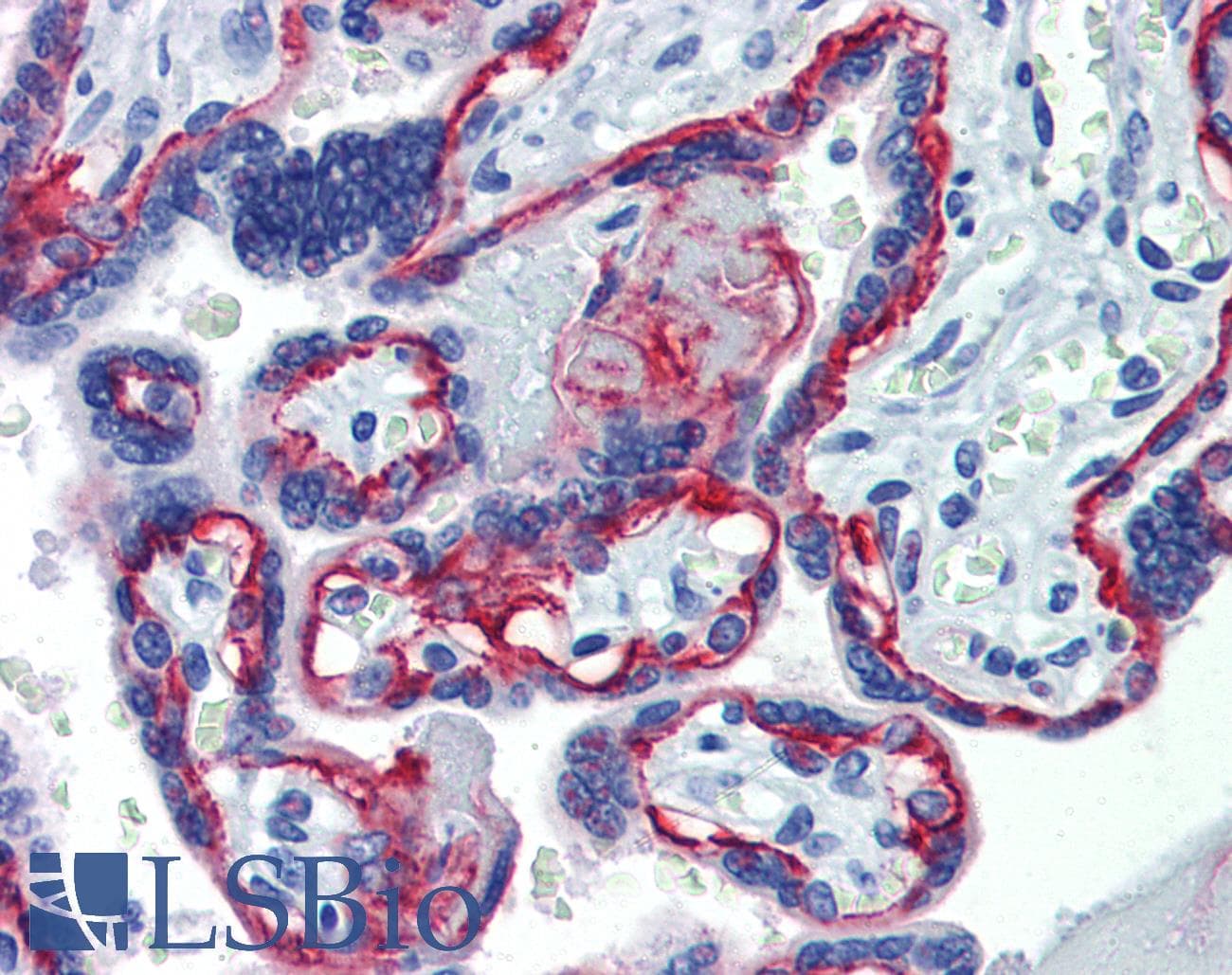IHC-plus™ ITGB4 / Integrin Beta 4 Antibody (clone 439-9B)