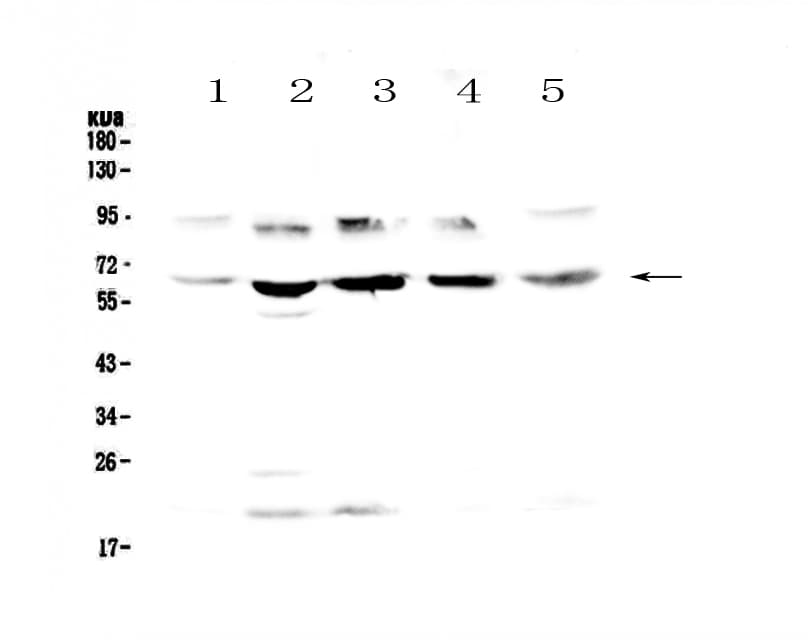 STS / ASC / Steroid Sulfatase Antibody
