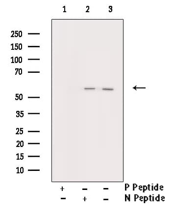 TP53 / p53 Antibody (phospho-Ser392)