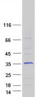 Human FHL2 Protein (Recombinant Myc-DDK (Flag))