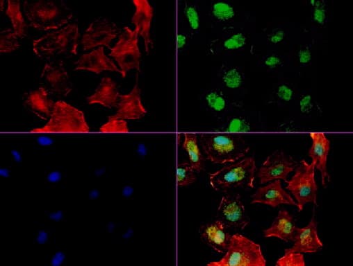 NBN / Nibrin Antibody (aa461-754, clone UMAB99)