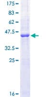 Human CD40 Protein (Recombinant GST)