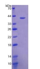 Human Neuropeptide Y / NPY Protein (Recombinant His-GST)