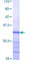 Human DNMT3A Protein (Recombinant GST, N-terminus)