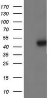 IDH1 / IDH Antibody (clone OTI1D1)