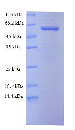 Mouse TLR7 / CD287 Protein (Recombinant GST)