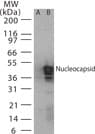 Polyclonal Rabbit anti-Coronavirus SARS-CoV Nucleoprotein Antibody (aa354-370, WB)
