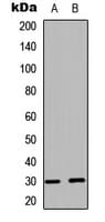 BCL2L1 / BCL-XL Antibody (phospho-Ser62)
