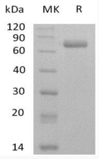 Coronavirus SARS-CoV-2 Spike Glycoprotein (Recombinant mFc, C-terminus)