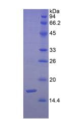 Human SEMA3F / Semaphorin 3F Protein (Recombinant His, N-Terminal)