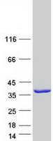 Human KCTD1 Protein (Recombinant Myc-DDK (Flag))