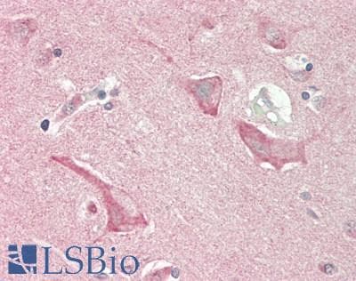 IHC-plus™ KAT2A / GCN5 Antibody (aa691-740)