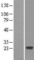 DCTN6 / Dynactin 6 Protein (Over-Expression Lysate Myc-DDK (Flag))