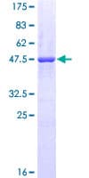 Human NQO2 Protein (Recombinant GST)