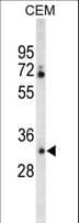 CA6 / Carbonic Anhydrase 6 Antibody (aa279-308)