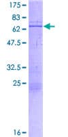 Human CBX4 Protein (Recombinant GST)