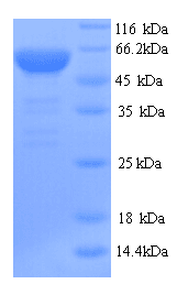 Human SMARCA4 / BRG1 Protein (Recombinant 6His, N-terminus)
