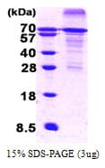 Human HSF1 Protein (Recombinant His)