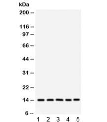 FABP1 / L-FABP Antibody