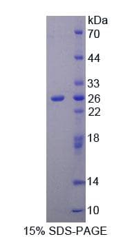KRT1 / CK1 / Cytokeratin 1 Protein (Recombinant His-S)