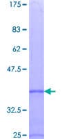 Human CCL7 / MCP3 Protein (Recombinant GST)
