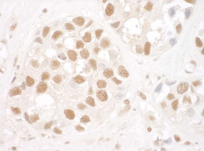 XRCC5 / Ku80 Antibody (aa150-200)