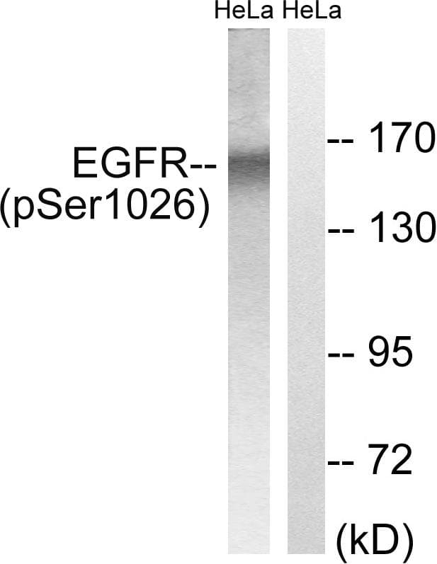 EGFR Antibody (phospho-Ser1026)