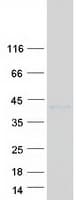 Human RNASET2 Protein (Recombinant Myc-DDK (Flag))