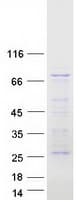 Human MAP3K7 / TAK1 Protein (Recombinant Myc-DDK (Flag))
