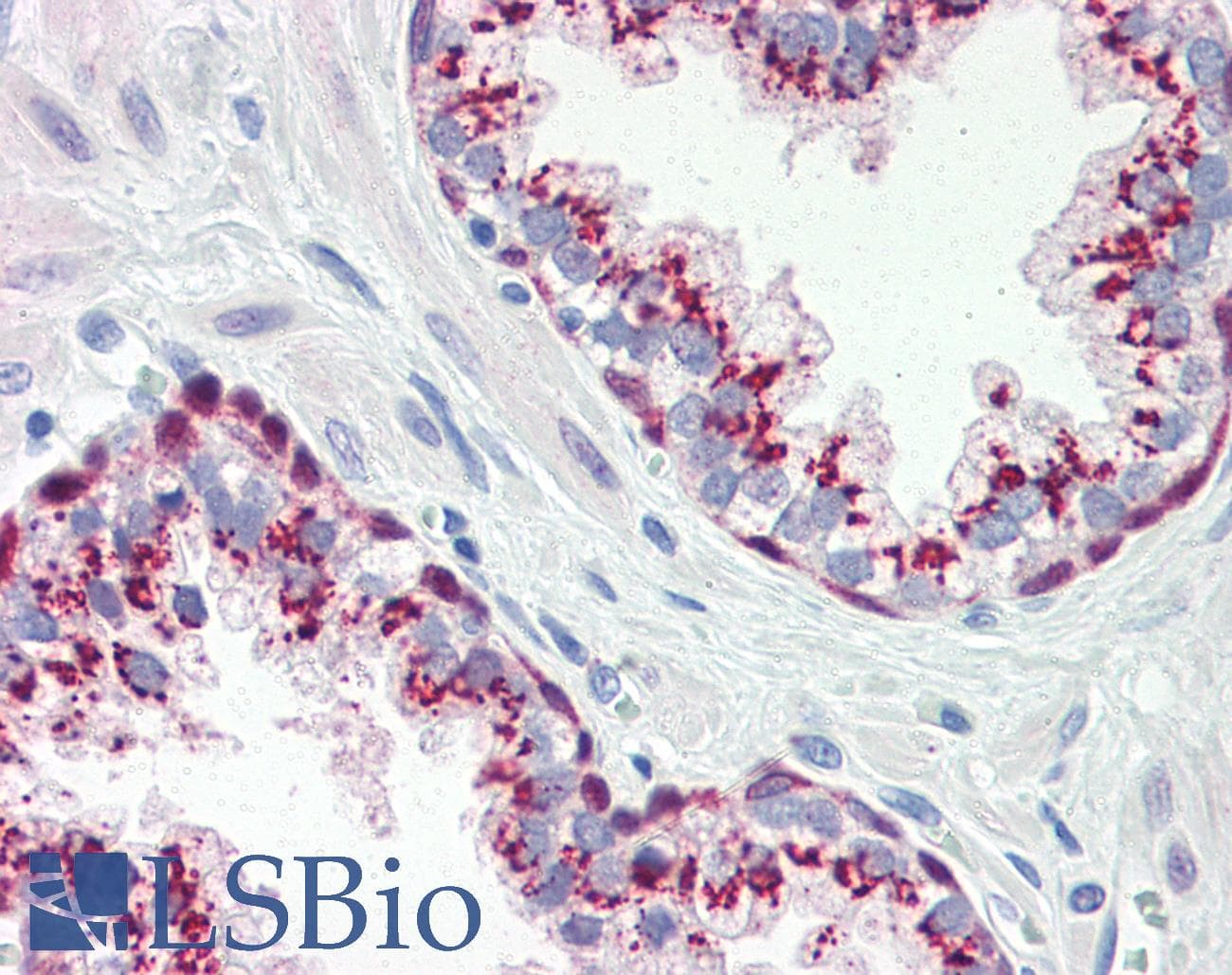 IHC-plus™ HSP70 / Heat Shock Protein 70 Antibody (aa1-641, clone 4E7)