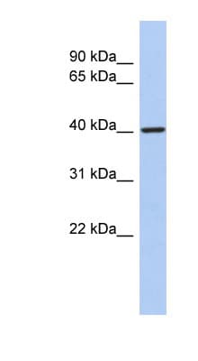 LDB2 Antibody (C-Terminus)