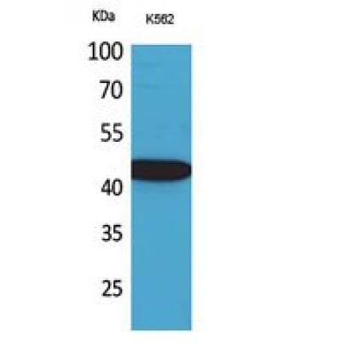 CX3CL1 / Fractalkine Antibody (221-270 aa, Internal)