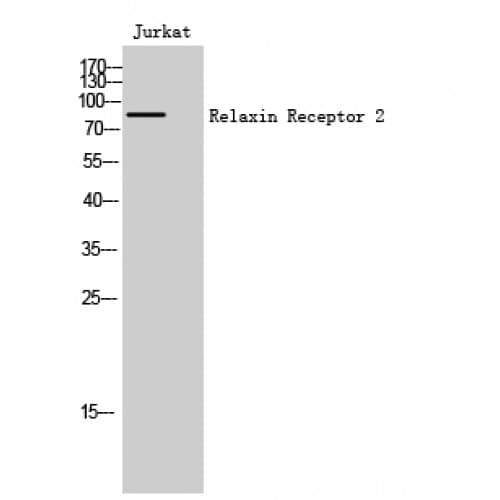 Polyclonal Rabbit anti-Human RXFP2 / LGR8 Antibody (90-170 aa, Internal, IF, WB)