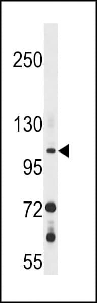 GUCY2F Antibody (aa828-856)