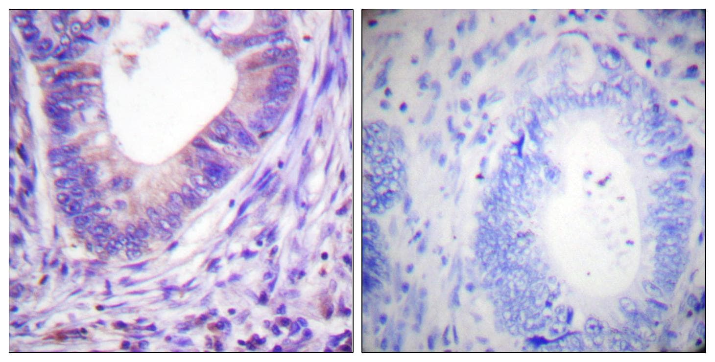 PRKAR2A/B Antibody (p197)