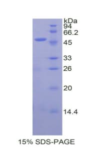 Rat Endostatin Protein (Recombinant His, N-Terminal)