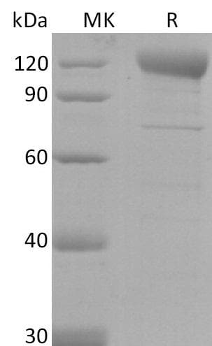 Coronavirus SARS-CoV-2 Spike Glycoprotein (Recombinant Fc, C-terminus)