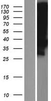 LDLRAD3 Protein (Over-Expression Lysate Myc-DDK (Flag))